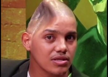 Jovem sobrevive a tiro de fuzil na cabeça, abandona o crime e entrega a vida a Jesus