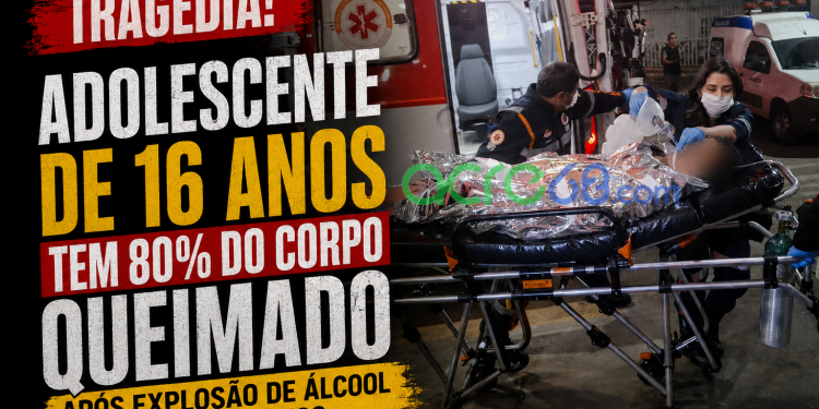 Adolescente de 16 anos tem 80% do corpo queimado após explosão de álcool em Rio Branco