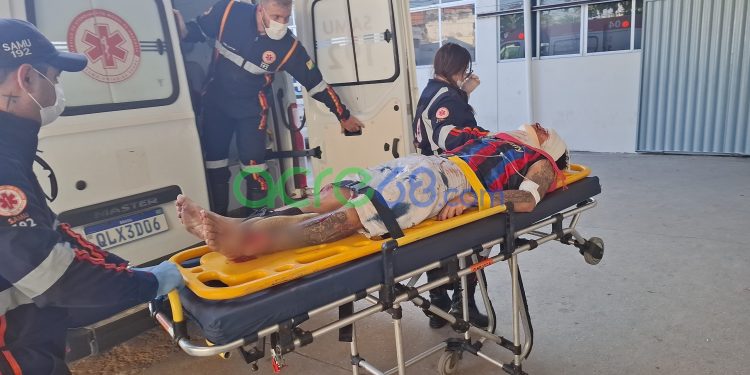 Acidente de moto deixa jovem ferido no Elevado Mamédio Bittar