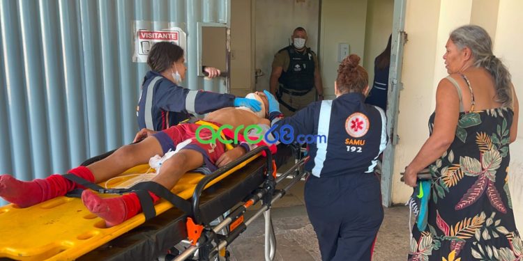 Atropelamento por ônibus deixa criança de 9 anos ferida na Estrada do Calafate Atropelamento por ônibus deixa criança de 9 anos ferida na Estrada do Calafate
