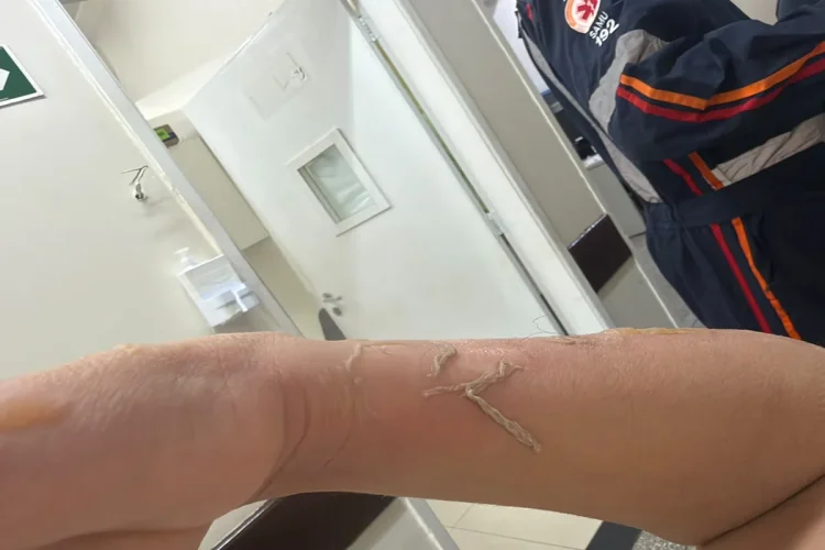 Sobrevivente narra terror após explosão de lancha no Lago: “Tochas humanas”