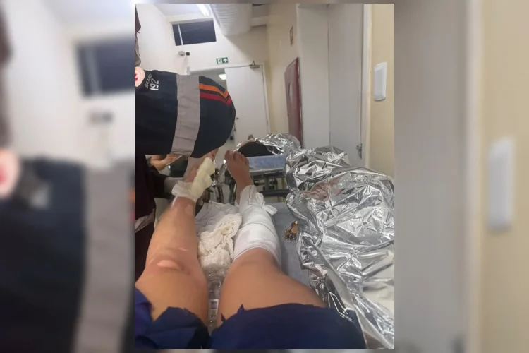 Sobrevivente narra terror após explosão de lancha no Lago: “Tochas humanas”