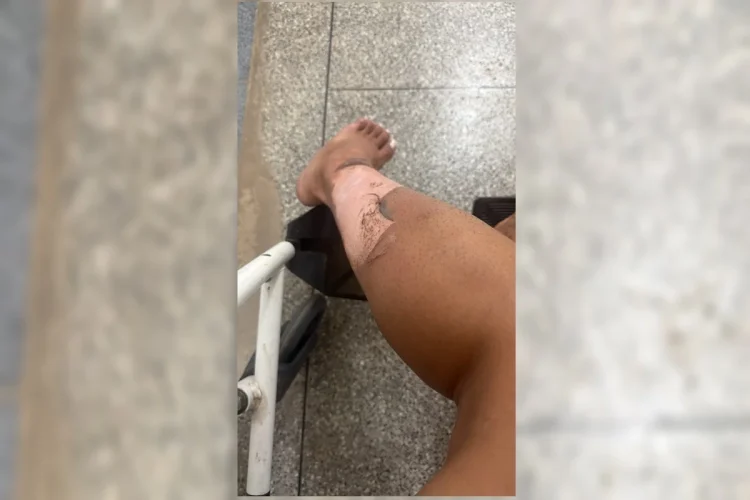 Sobrevivente narra terror após explosão de lancha no Lago: “Tochas humanas”