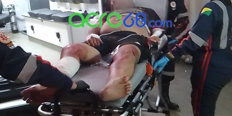 Motociclista colide contra placa de sinalização na Avenida Getúlio Vargas após perder controle da direção