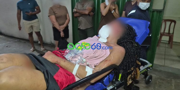Agressão brutal deixa jovem despido e com lesões severas no rosto em parque da Capital