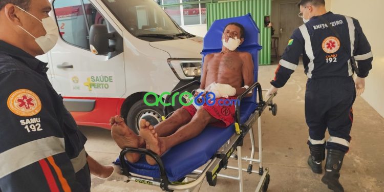 Quatro suspeitos armados com terçado atacam morador de 58 anos na Cidade do Povo