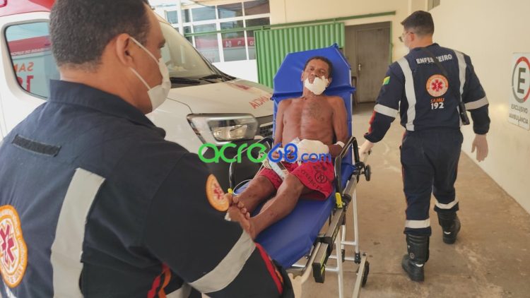 Quatro suspeitos armados com terçado atacam morador de 58 anos na Cidade do Povo