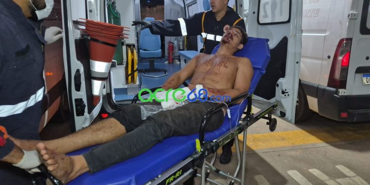 Violência em Rio Branco: Homem é espancado por dupla armada com capacetes em frente a estabelecimento
