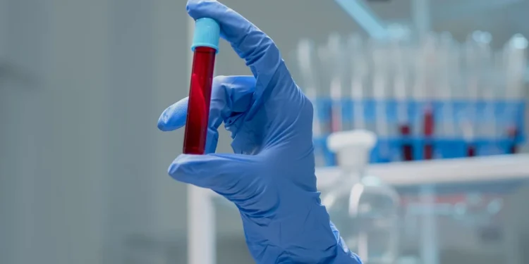 Novo exame de sangue que detecta mais de 50 tipos de câncer chega ao Brasil